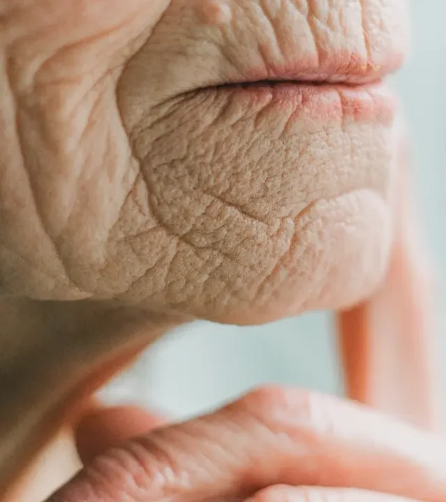 Wrinkle Treatment